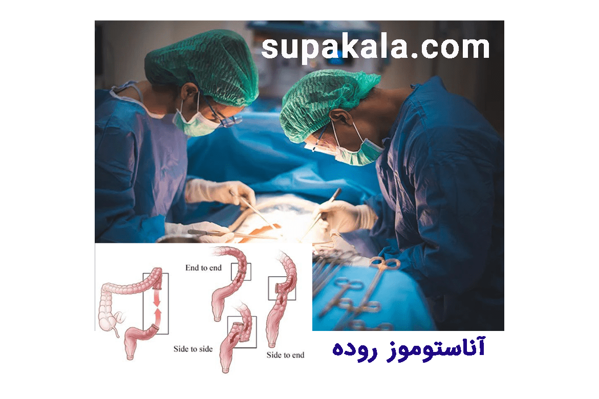  آناستوموز روده