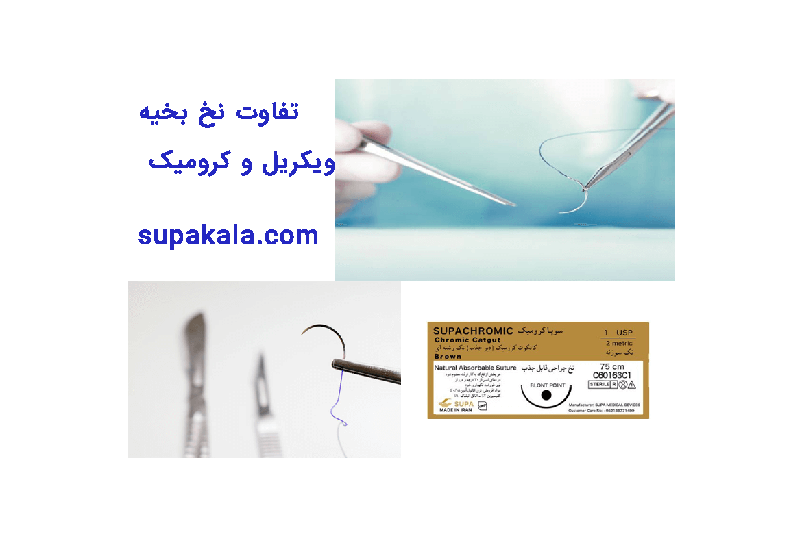 تفاوت نخ بخیه ویکریل و کرومیک